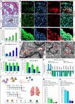 PSCA Antibody in Immunohistochemistry (Paraffin) (IHC (P))