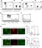 Tau Antibody in Western Blot (WB)