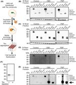 Tau Antibody in Western Blot (WB)