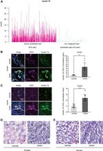 CD31 Antibody in Immunohistochemistry (IHC)
