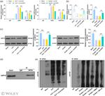 GPX4 Antibody in Immunoprecipitation (IP)