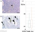 CD20 Antibody in Immunohistochemistry (Paraffin) (IHC (P))