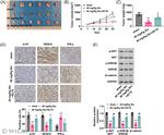 IFN gamma Antibody in Immunohistochemistry (IHC)