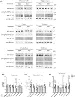 PLK2 Antibody in Western Blot (WB)