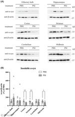PLK2 Antibody in Western Blot (WB)
