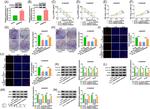 ANKRD22 Antibody in Western Blot (WB)