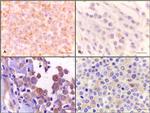 Beclin 1 Antibody in Immunohistochemistry (Paraffin) (IHC (P))