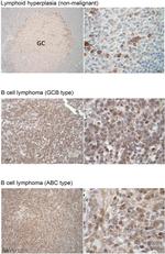 SREBP2 Antibody in Immunohistochemistry (IHC)