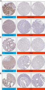 KLF2 Antibody in Immunohistochemistry (IHC)