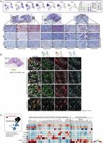 TAGLN Antibody in Immunohistochemistry (Paraffin) (IHC (P))