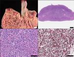CD20 Antibody in Immunohistochemistry (Paraffin) (IHC (P))
