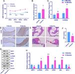 CHOP Antibody in Western Blot, Immunohistochemistry (Paraffin) (WB, IHC (P))