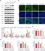 HHIP Antibody in Western Blot (WB)