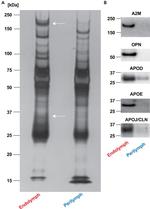 Apolipoprotein D Antibody in Western Blot (WB)