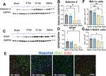 GFAP Antibody in Western Blot (WB)