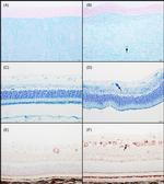 LIMP2 Antibody in Immunohistochemistry (Paraffin) (IHC (P))