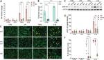 Phospho-NFkB p65 (Ser536) Antibody in Western Blot (WB)