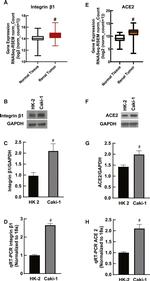 ACE2 Antibody in Western Blot (WB)