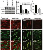 ACE2 Antibody in Western Blot (WB)