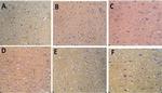 Synaptophysin Antibody in Immunohistochemistry (Paraffin) (IHC (P))