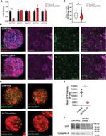 SSTR3 Antibody in Immunocytochemistry (ICC/IF)