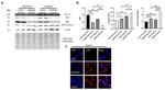 LC3B Antibody in Western Blot, Immunocytochemistry (WB, ICC/IF)