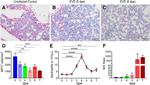 Myeloperoxidase Antibody in Immunohistochemistry (IHC)