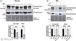 Neurocan Antibody in Western Blot (WB)