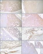 DPYSL3 Antibody in Immunohistochemistry (Paraffin) (IHC (P))