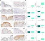 CD123 Antibody in Immunohistochemistry (IHC)
