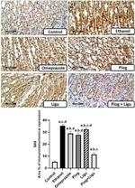 Bax Antibody in Immunohistochemistry (Paraffin) (IHC (P))