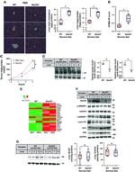 SREBP1 Antibody in Western Blot (WB)