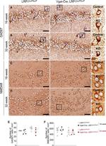 NMDAR1 Antibody in Immunohistochemistry (Paraffin) (IHC (P))