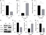 LTC4S Antibody in Western Blot (WB)