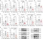 HIF1A Antibody in Western Blot (WB)