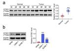 GTSE1 Antibody in Western Blot (WB)