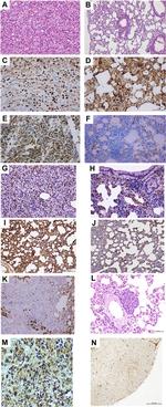 CD56 (NCAM) Antibody in Immunohistochemistry (Paraffin) (IHC (P))
