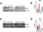 PMCA ATPase Antibody in Western Blot (WB)