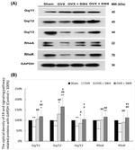 GRK1 Antibody in Western Blot (WB)