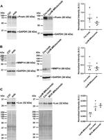LOX Antibody in Western Blot (WB)
