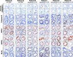 Caspase 8 Antibody in Immunohistochemistry (Paraffin) (IHC (P))