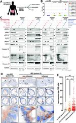 Caspase 8 Antibody in Immunohistochemistry (Paraffin) (IHC (P))