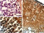 iNOS Antibody in Immunohistochemistry (IHC)