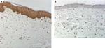 IL-17A Antibody in Immunohistochemistry (Paraffin) (IHC (P))