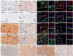 PYGM Antibody in Immunohistochemistry (Paraffin) (IHC (P))