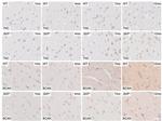 Brevican Antibody in Immunohistochemistry (Paraffin) (IHC (P))