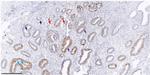 MUTYH Antibody in Immunohistochemistry (Paraffin) (IHC (P))