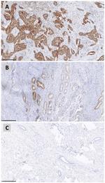 MUTYH Antibody in Immunohistochemistry (Paraffin) (IHC (P))