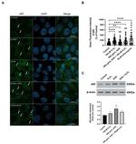 SQSTM1 Antibody in Western Blot (WB)