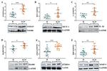 S100A9 Antibody in Western Blot (WB)